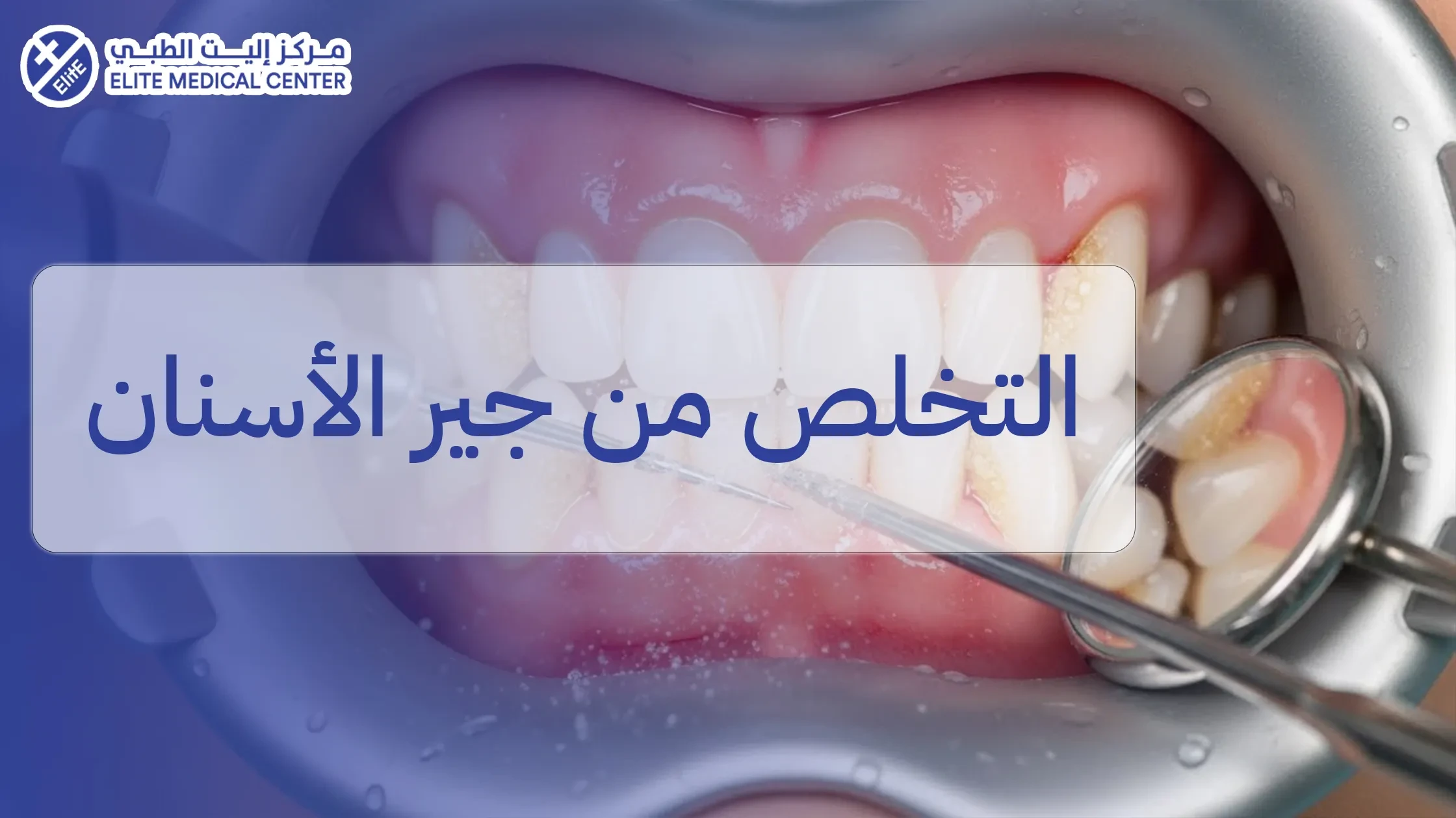 التخلص من جير الأسنان