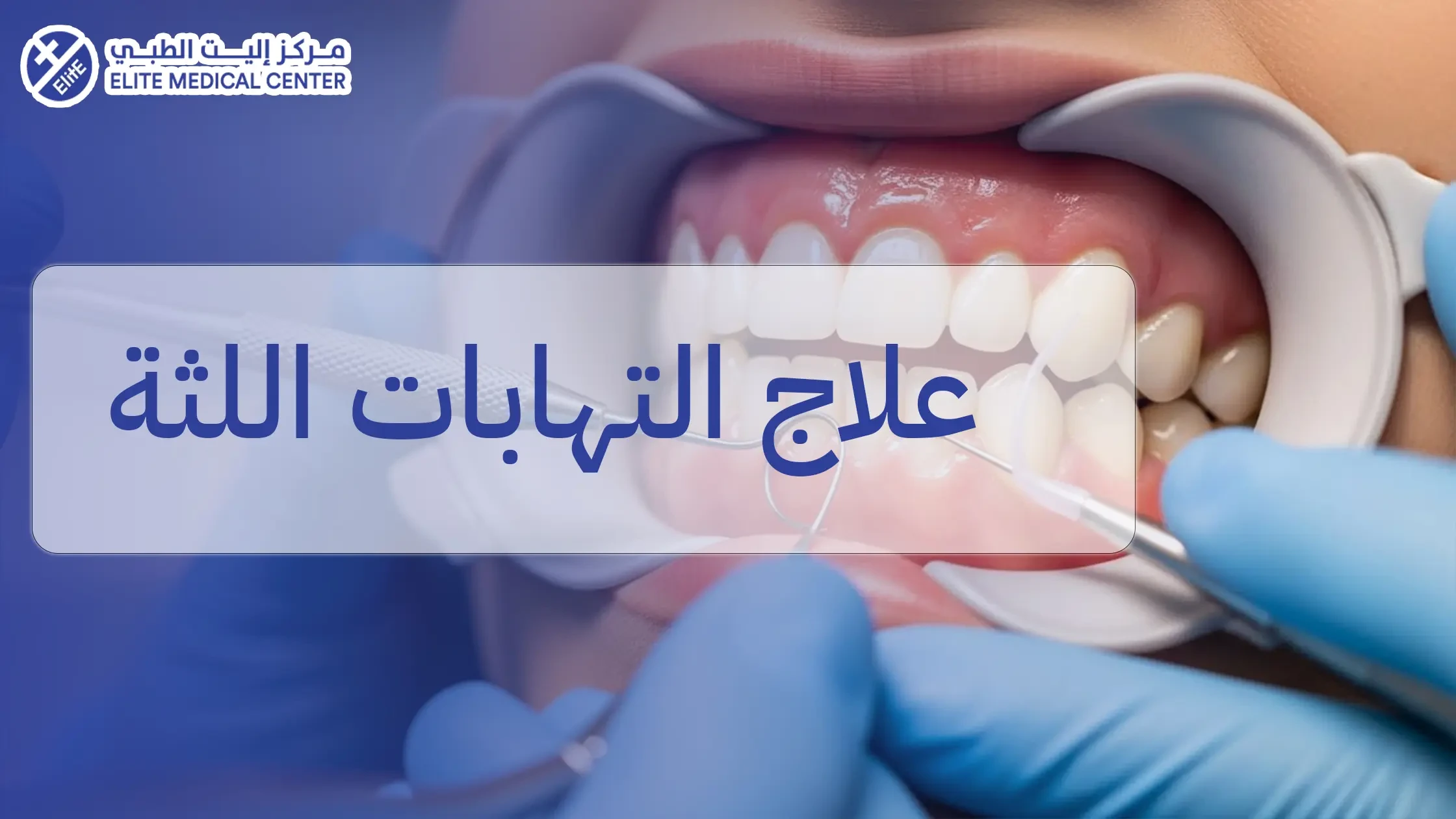علاج التهابات اللثة