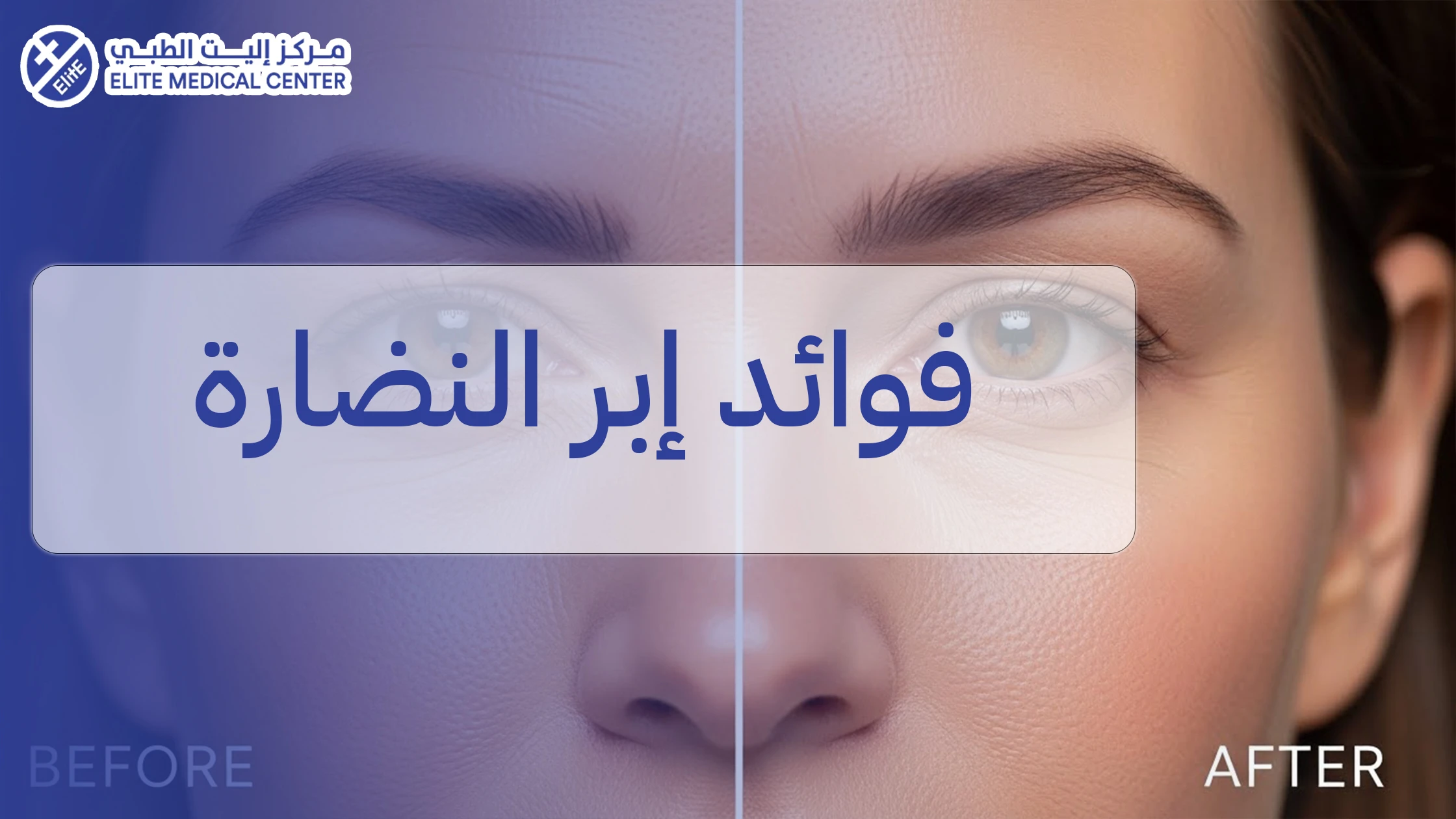 فوائد إبر النضارة: متى تكون خيارًا مناسبًا؟ وما الذي تقدمه للبشرة فعليًا؟