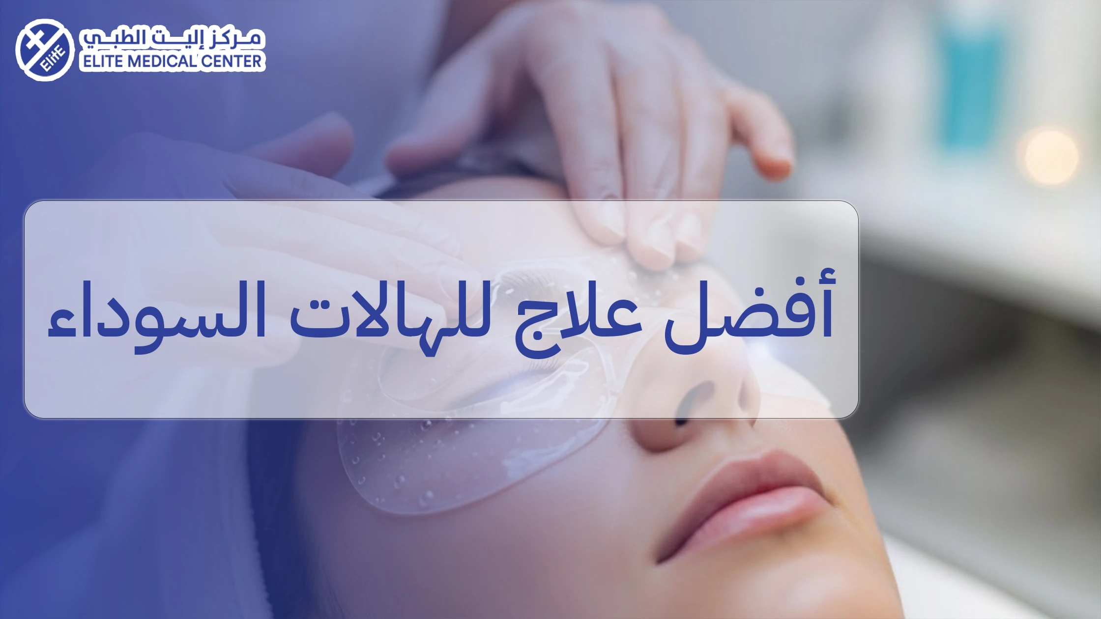 علاج الهالات الوراثية: لماذا تظهر؟ وهل يمكن تحسينها فعليًا؟