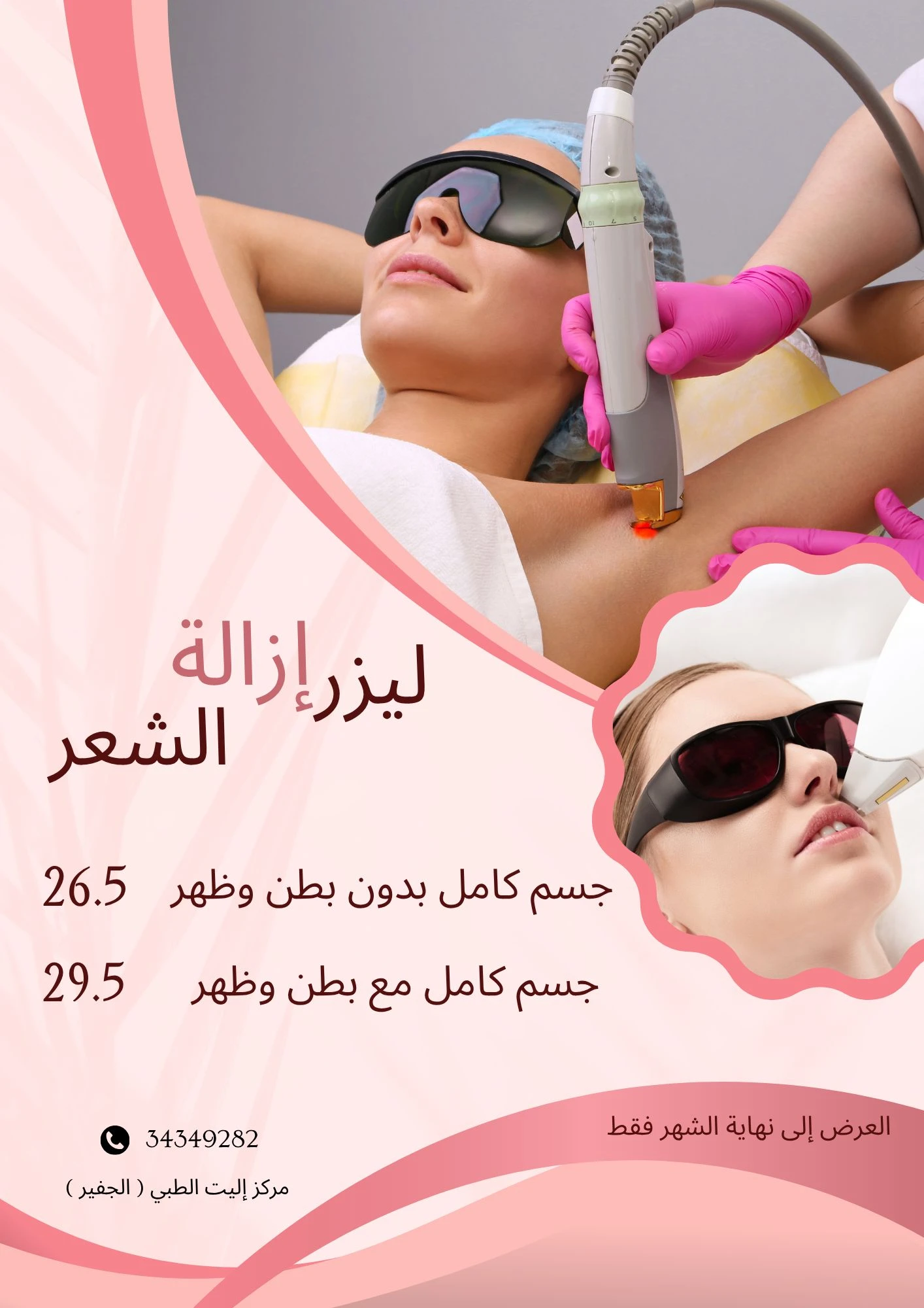 جلسة إزالة الشعر