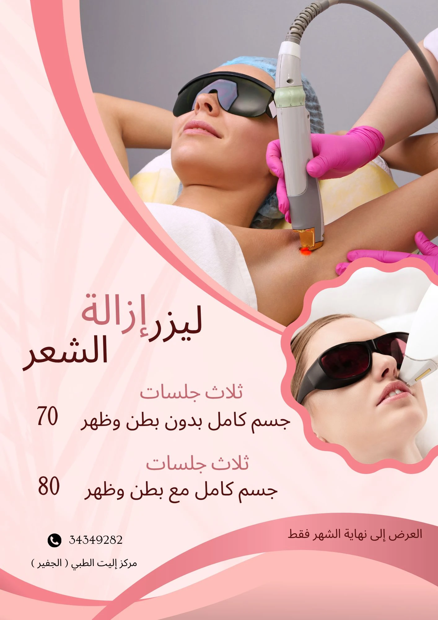 3 جلسات ليزر إزالة الشعر