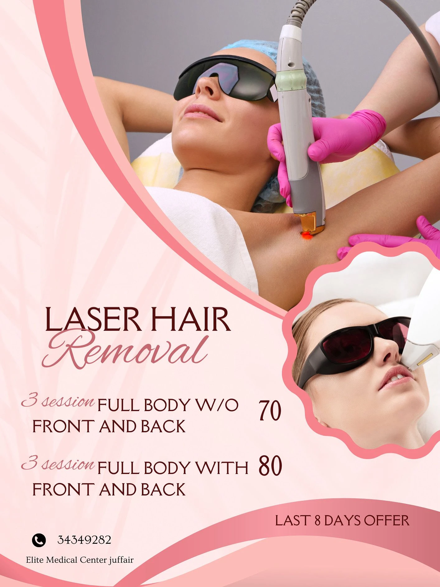 3 جلسات ليزر إزالة الشعر