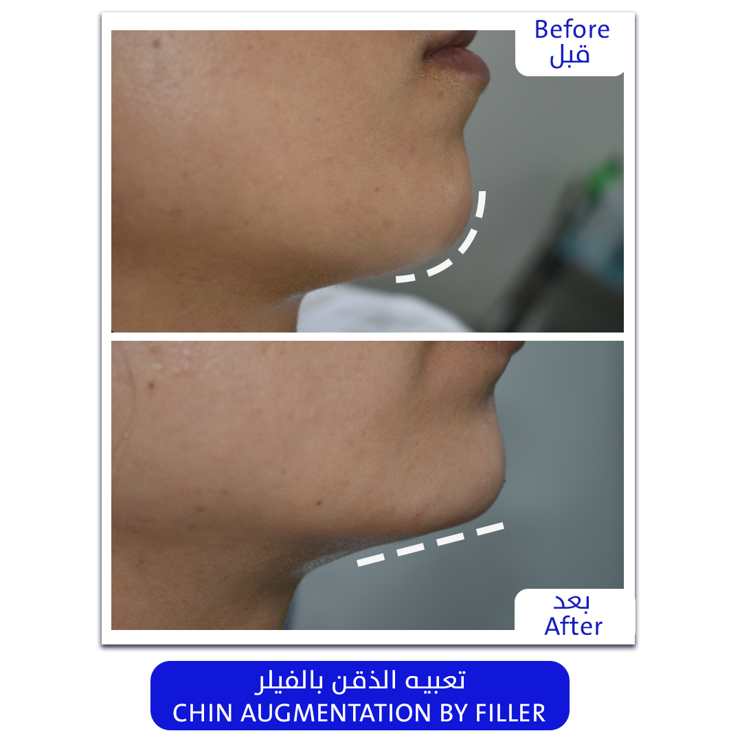 Best Plastic Surgery Clinic in Bahrain - Elite Medical Center